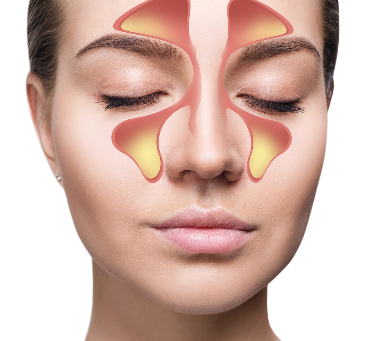 An image of a woman's face highlighting the location and shape of the sinuses.